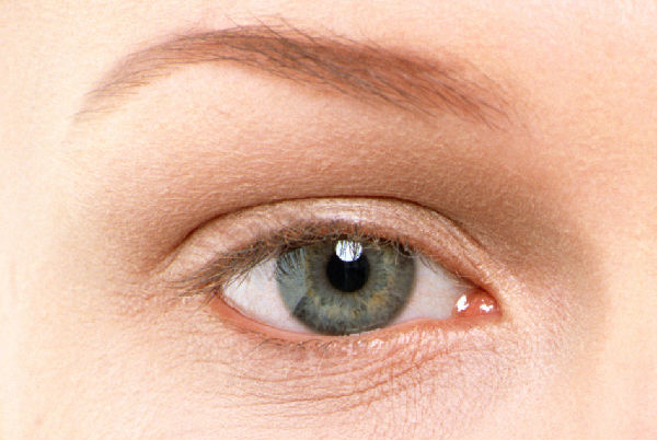 高度近视需预防黄斑病变