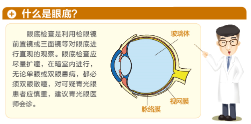 【图文解答】哪些人更需要做眼底检查