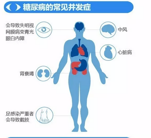 你造吗？糖尿病晚期眼睛会失明！