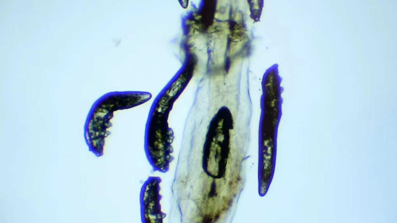 冬季干眼高发，久治不愈或是睫毛上的螨虫在作祟！